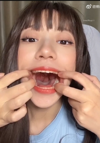 核酸